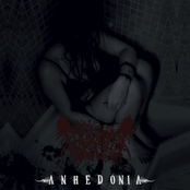 Anhedonia