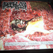 Disgusting Human Seepage