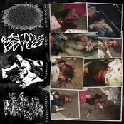 Removal of Defining Human Features