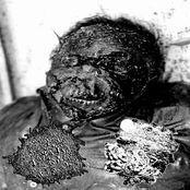 HEMATOCOLPOS DRAINED FROM IMPERFORATE HYMEN / CAMPYLOBACTOSISLAGOONSEA-TRASHMEGLYLYSISAQUATICSTASISIALECTOMY
