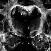 Dead Brain Fixation