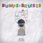 Ugly God: Bumps & Bruises (Deluxe)