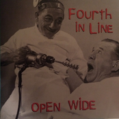 Open Wide
