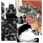 Hemorrhagic Pyrexia Virus / Gonococcus split