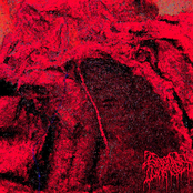 Intracellular Degeneration of the Integrity of the Vascular Wall