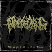 Strangled with the Bowel
