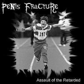 Assault Of The Retarded