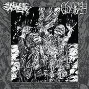 A Clinical Debate on the Implementation of Traumatic Hemicorporectomy Procedure and Discussion of Ethics Regarding Disfiguring Surgeries