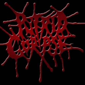 Putrid Corpse