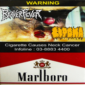 Cigarette Causes Neck Cancer