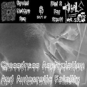 Crossdress Asphyxiation And Autoerotic Fatality
