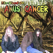 The Worst Of Anus Cancer