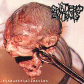 Echoencephalographic Tumors by Splattered Entrails