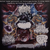 Vertical Banded Gastroplasty & Ureterosigmoidostomy Following Cranial Liquidation & Bleeding In Advanced Organ Disease