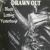 Blood Letting Yesterdays