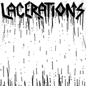 Lacerations