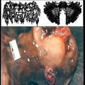 Cadaver Waste / Carcinomas of Unknown Primary Origin