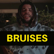 Bruises