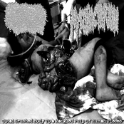 Total Crushed Body To a Mangled Pulp of Human Pieces