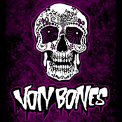 Vonbones