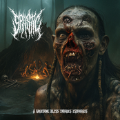 A Gruesome Bliss Invades Esophagus