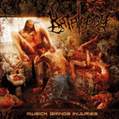 Music Brings Injuries