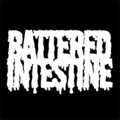 battered intestine