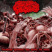 Pulmonary Squishings From Behind The Wheel