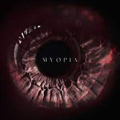 Myopia