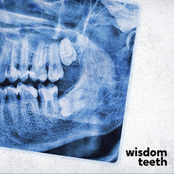 Wisdom Teeth