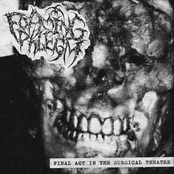 Final Act In The Surgical Theatre