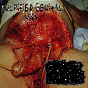 Amorphous Ptoma On Decay / Pulpified Genital Junk