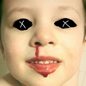 Blutige Nasen und Riesenpupillen