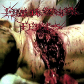 Pathological Postmortem Procedures