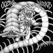 Autopsy Turvy by Oozing Wound