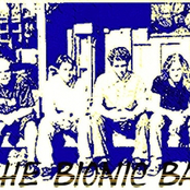 The Bionic Band