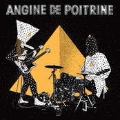 Angine De Poitrine: Vol.II