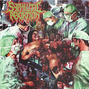 Syphilitic Abortion / Expurgo