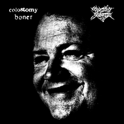 Colostomy Boner / Colostomy Baguette?