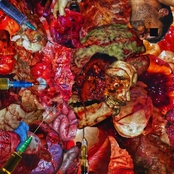 Full Forensic Gastric Bypass