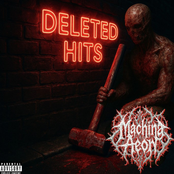 Deleted Hits