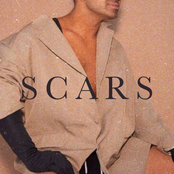 Scars