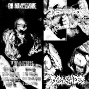 Desvelado / Dischwaser Split - Single