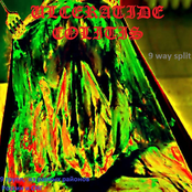 Ulceratide Colitis - 9 Way Split