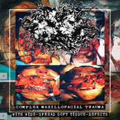 Complex Maxillofacial Trauma With Wide-Spread Soft Tissue Defects