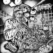 MEDICAL CANNIBALISM (HACKED APART SPLIT)