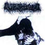 Anatomical Septicemia