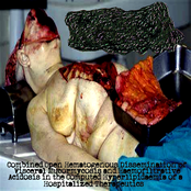 Combined Open Hematogenous Dissemination of Visceral Mucormycosis and Haemofiltrative Acidosis in the Computed Hyperlipidaemia of a Hospitalized Therapeutics