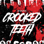 Crooked Teeth