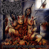 Preservation Cerebrum by Suicide Of Disaster